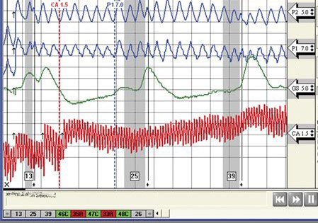 In Simi Valley polygraph